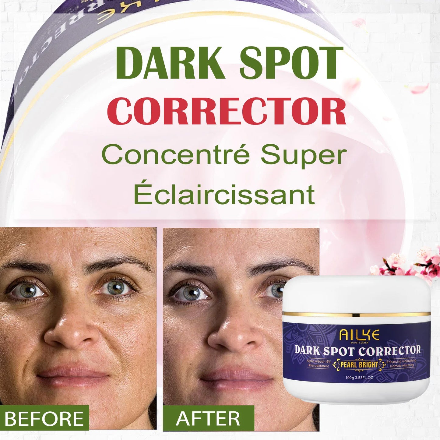 AILKE Lighten Face Cream Dark Spots Remover for Face Hands Body and Knuckles Even Skin Tone Improve Dull Skin 100ml